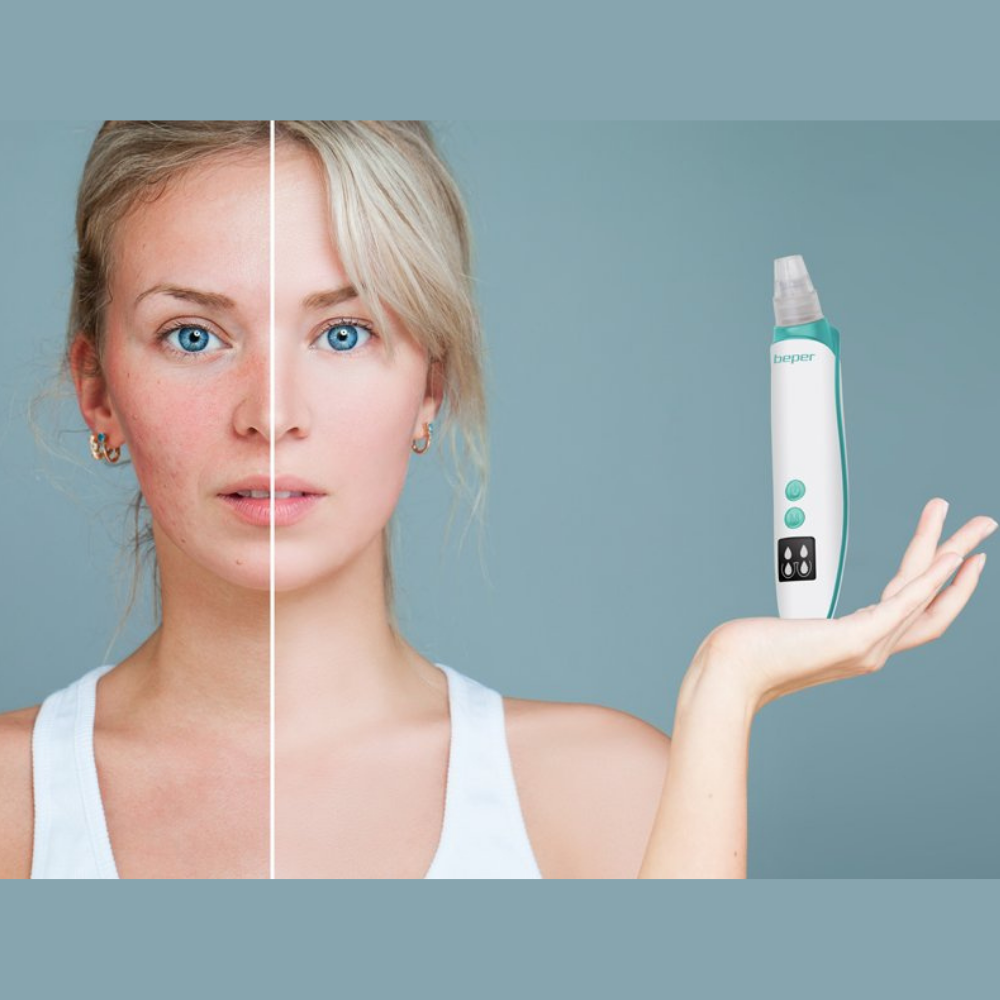 Beper Rechargeable Pore Vacuum And Black Head Remover