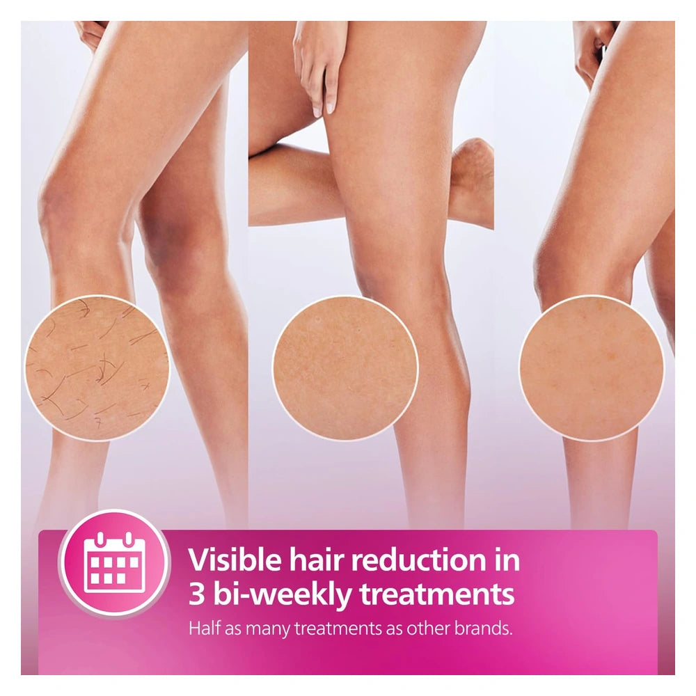 Philips Lumea IPL 8000 Series BRI940